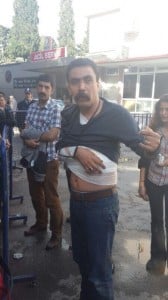 Selçuk Kozağaçlı Soma'da  darp edilerek gözaltına alınmıştı. 