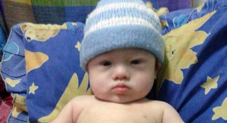 Fotoğraflar, Avustralya kanalı ABC News'dan alınmıştır.