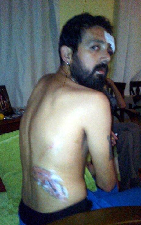 gezi tazminat2