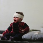 An injured child sits on a bed in a field hospital after what activists said were air strikes by forces loyal to Syria's President Bashar al-Assad in Douma