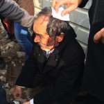 yarali @seldalkan