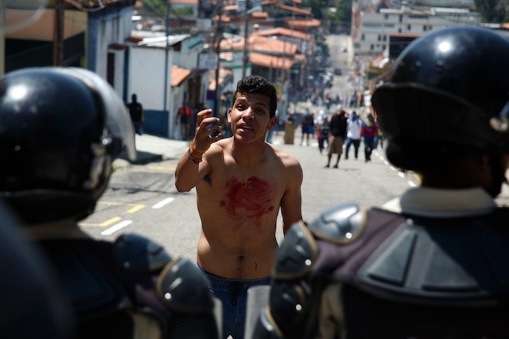Boy with blood on his chest and hand gestures in front of police after 14-year-old student Kluiver Roa died during a protest in San Cristobal