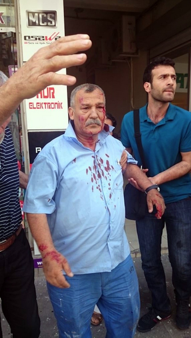 hdp adana patlama @ozgurgundem