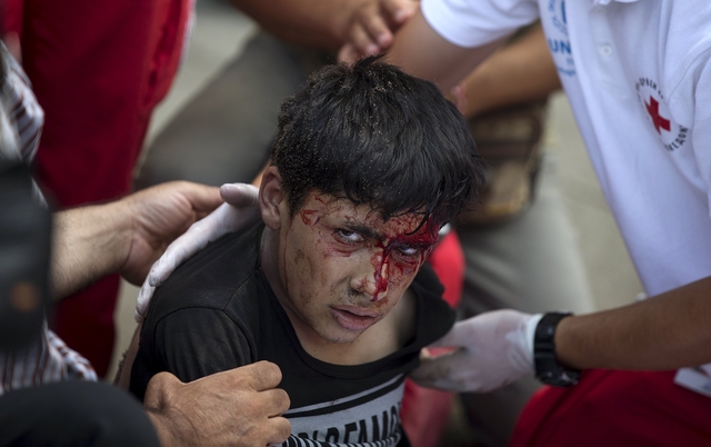 Migrant boy reacts after he was shocked by electricity, while trying to climb a utility pole, at Gevgelija train station in Macedonia, close to the border with Greece