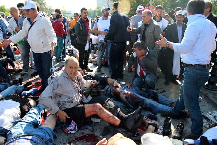 ATTENTION EDITORS - VISUAL COVERAGE OF SCENES OF INJURY OR DEATH An injured man asks for help after an explosion during a peace march in Ankara, Turkey, October 10, 2015. At least 20 people were killed in explosions on Saturday outside the main train station in the Turkish capital Ankara where people were gathering for a peace march, Dogan news agency reported. A Reuters reporter at the scene saw at least 15 bodies covered by flags, with bloodstains and body parts scattered on the road. REUTERS/Tumay Berkin