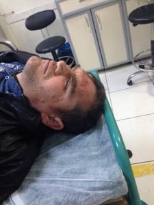 Jandarma saldırısında darp edilen madenci Erdoğan Merdim. Fotoğraf: facebook.com/sosyalhaklardernegi/ 