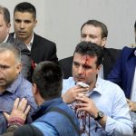 An injured leader of the Social Democrats Zoran Zaev is escorted out of the parliament in Skopje