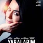 yaralarimasktandir