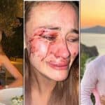 model-cesme-instagram