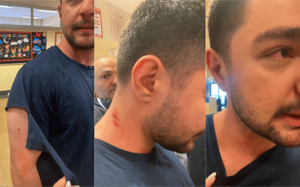 AKP’liler TİP üyesine saldırdı. (Twitter)