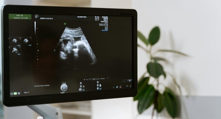 Kürtaja bir 'politik' engel daha