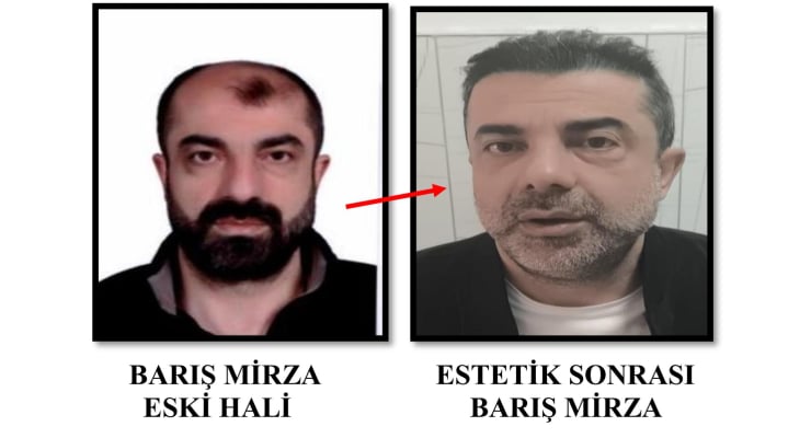 'Ameliyatla yüzünü değiştiren' cinayet zanlısı yedi yıl sonra yakalandı