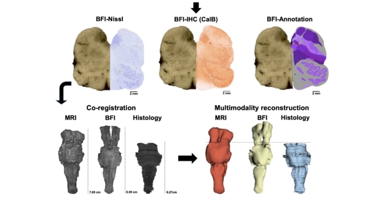 Diagram showing a multimodal brain tissue workflow: BFI-Nissl, BFI-IHC (CalB), and BFI-Annotation on top; arrows to co-registration with MRI and histology; final multimodality reconstruction from aligned datasets.