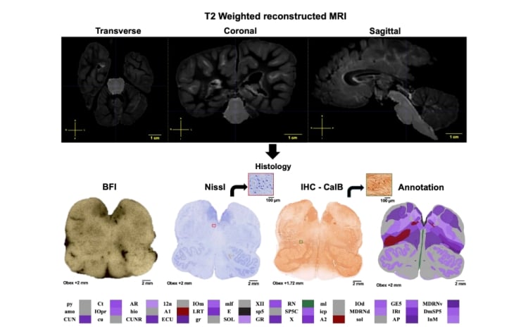 T2-weighted MRI brain slices (transverse, coronal, sagittal) above; below, histology panels (BFI, Nissl, IHC-CalB) with an annotation map.