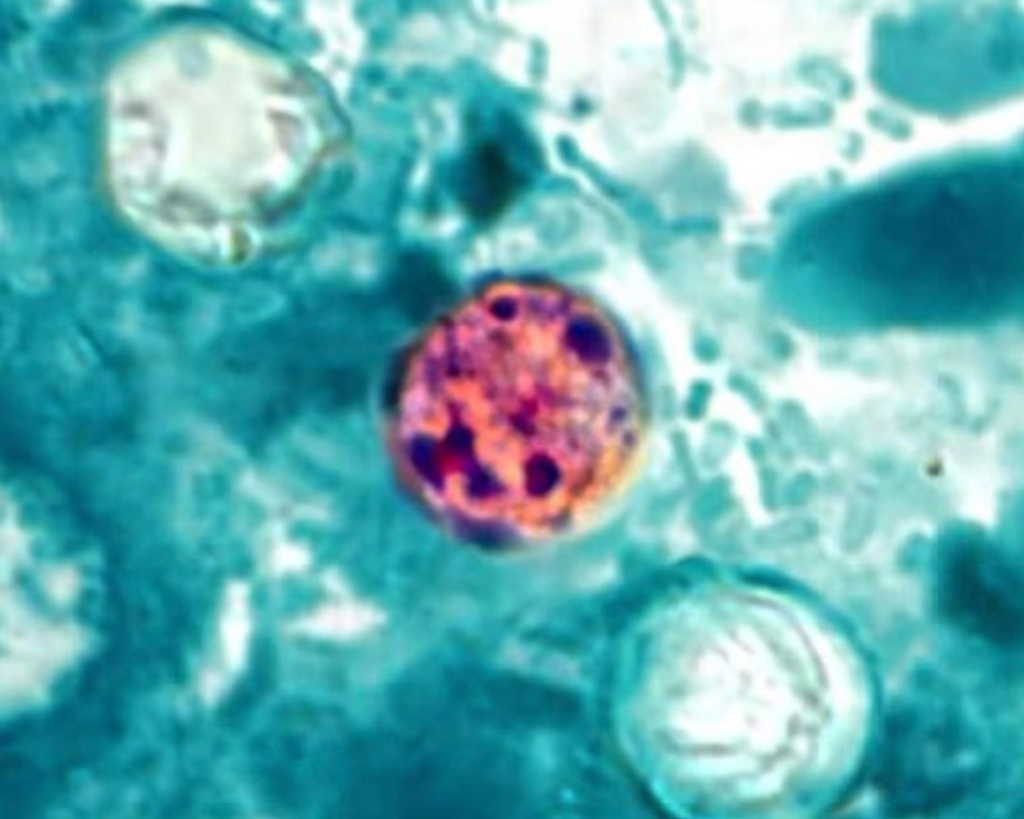 Close-up of turquoise abstract texture with a pink-purple circular spot near the bottom center.